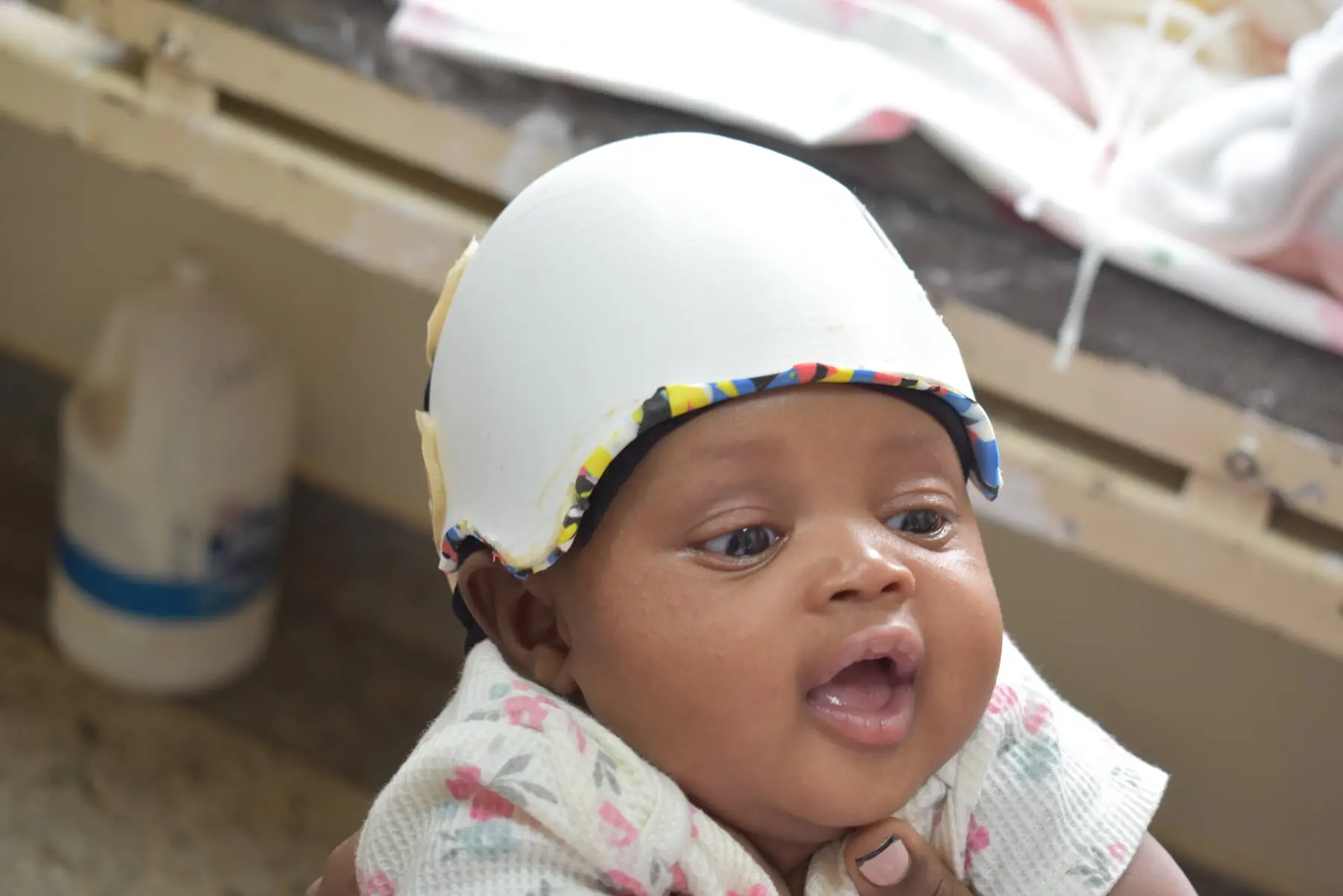 A baby wearing a white 3D-printed helmet looks up and smiles.