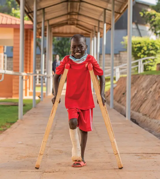 A smiling boy with a cast on his lower leg walks on wooden crutches along a covered hospital walkway.