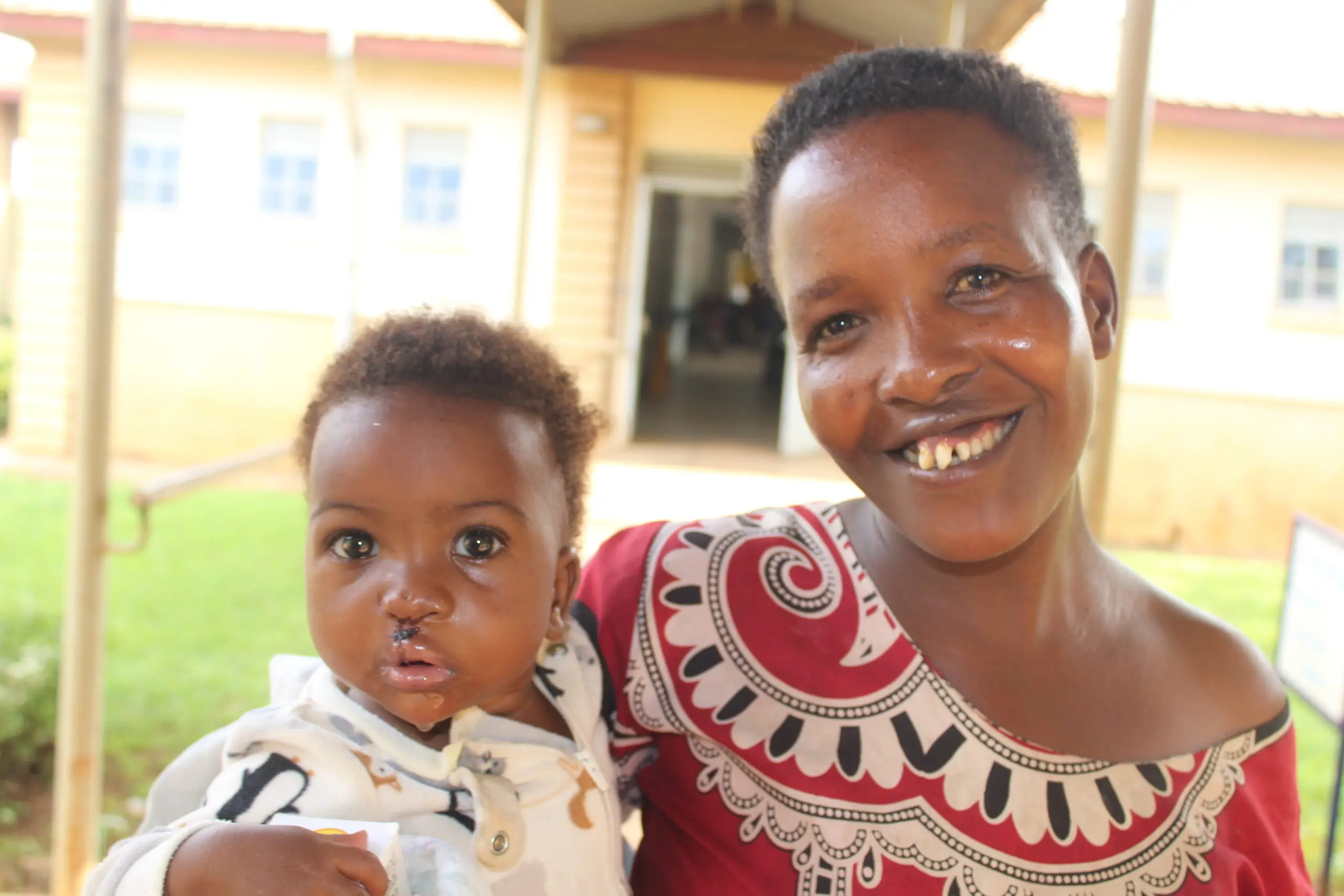 A smiling mother outside the hospital holds her baby, whose lip shows fresh stitches after cleft surgery.