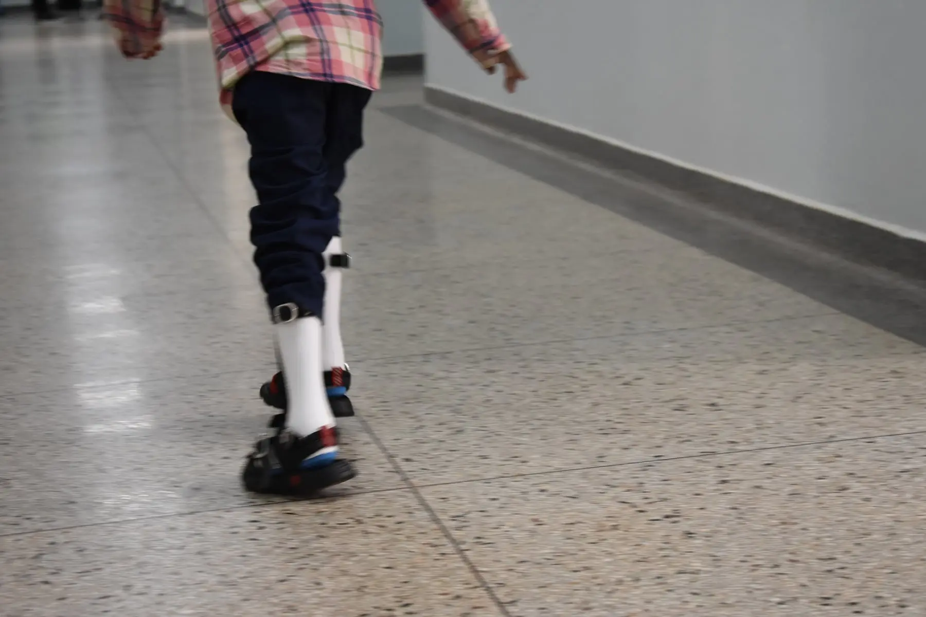 Kimra walks along a hospital corridor wearing white ankle-foot orthoses on both legs.