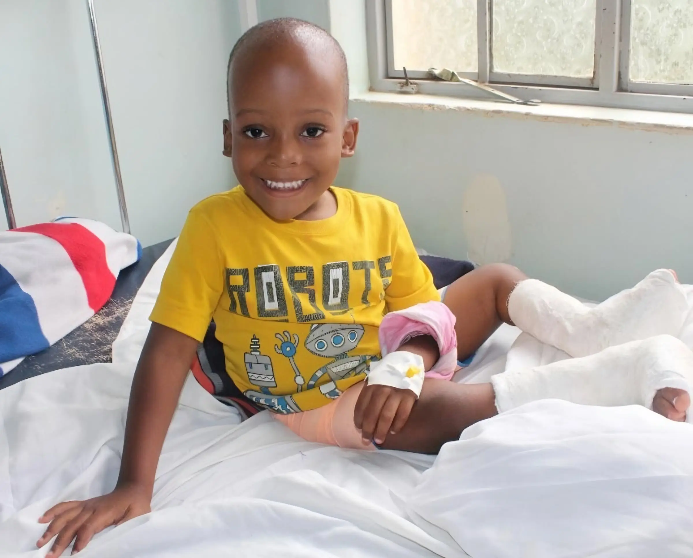 A smiling boy in a yellow T-shirt sits up in a ward bed with both legs in casts.