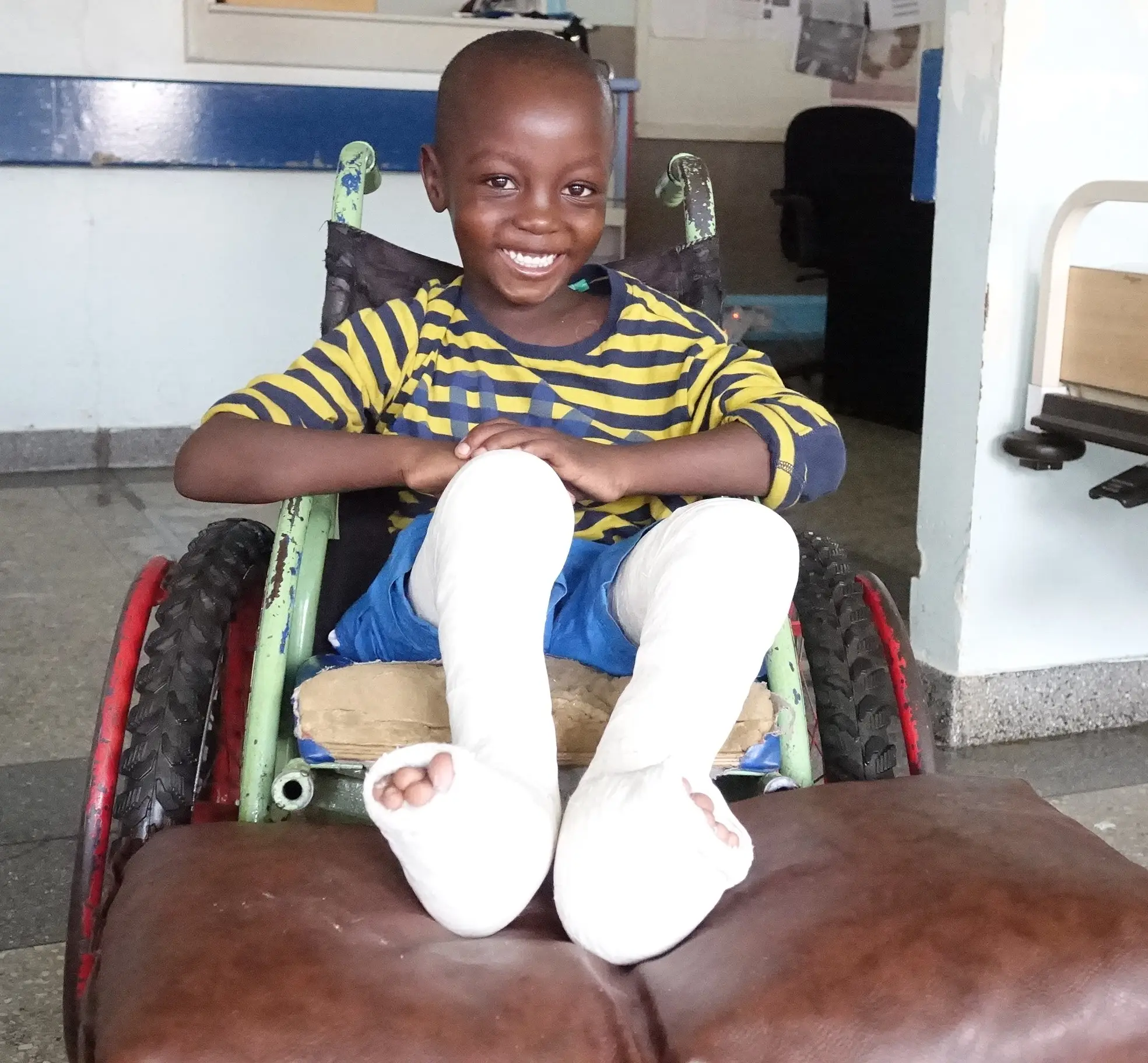 A boy smiles from a wheelchair with both legs in fresh white casts.