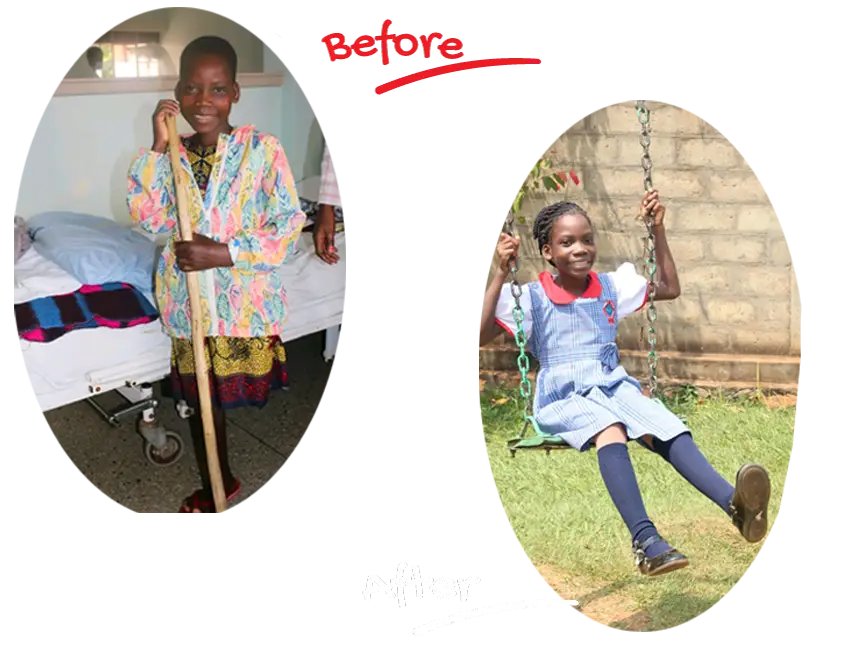 Before: a girl stands with a walking stick beside a ward bed. After: the same girl, in school uniform, plays on a swing.